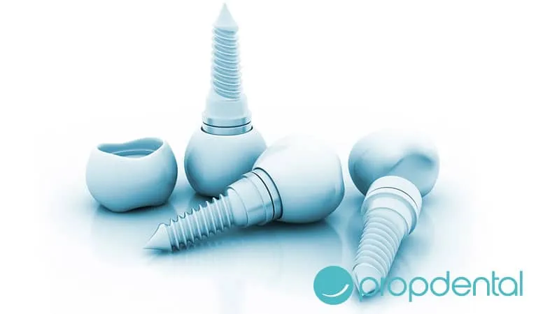 problemes-implants-dentaires